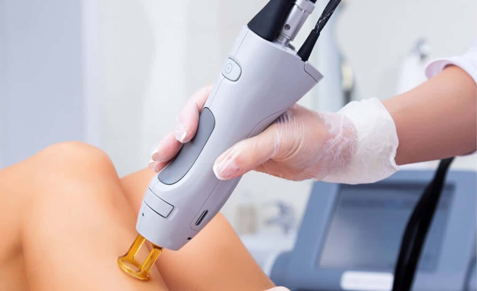 Aποτρίχωση με laser Αλεξανδρίτη